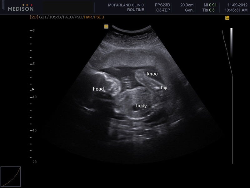 Sonogram baby website